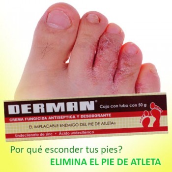Derman Antifungal Cream for the Treatment of Athlete's Foot 0.88 0z (25g)